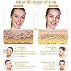 Face Massager Lift Skin Tightening Machine anti Aging EMS Beauty Devices Wrinkle Removal Facial Eye Skin Care Massager Tools